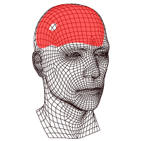 Ilustración dolor de cabeza por infección cerebral o abceso