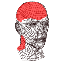 Ilustración dolor de cabeza por inflamación de meninges