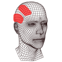 Ilustración dolor de cabeza migraña y descripción